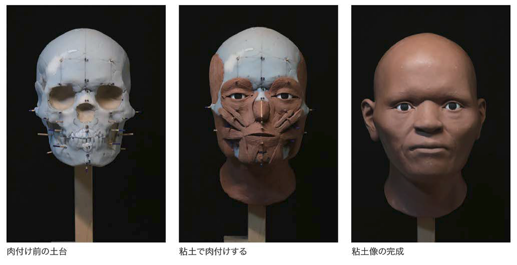 300508_骨の復元（新着記事）