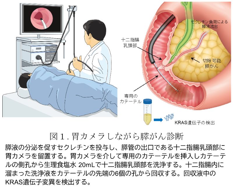 プレスリリース参考図