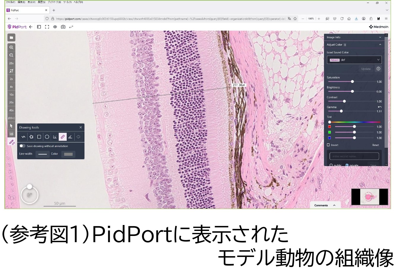 椋田先生プレスリリース