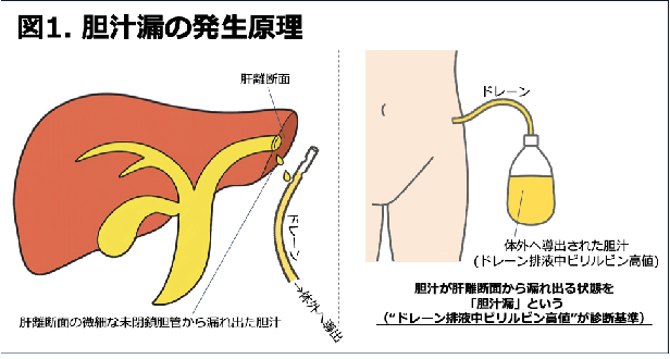 花木先生プレスリリース