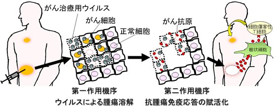中村先生プレスリリース