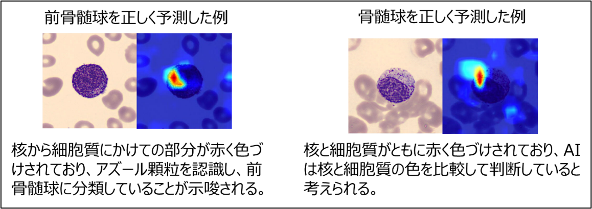 岩田先生プレスリリース