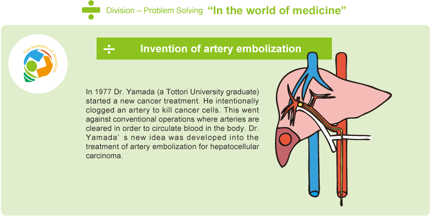 In the world of medicine - Invention of artery embolization