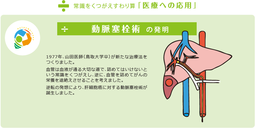 応用：動脈塞栓術の発明