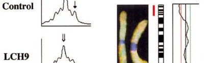 Fig 1 of Hum Pathol I Murakami