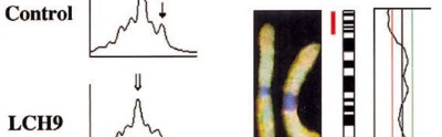 Fig 1 of Hum Pathol I Murakami