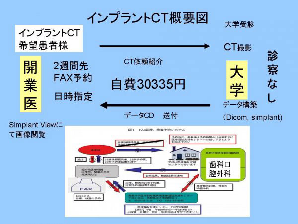 インプラントCT概要図