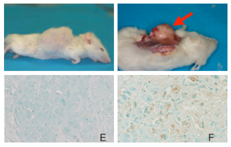 抗癌剤 セラミド研究 鳥取大学医学部感覚運動医学講座 耳鼻咽喉 頭頸部外科学分野 抗癌剤 セラミド研究 鳥取大学医学部感覚運動医学講座 耳鼻咽喉 頭頸部外科学分野