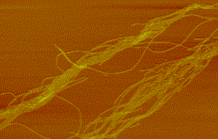 蛋白質アミロイド繊維の原子間力顕微鏡写真