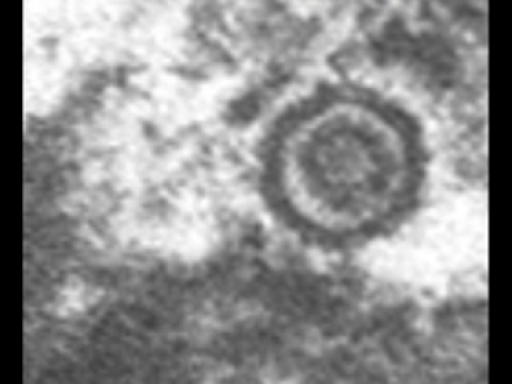 EBV capture by K. Nagata, MD, PhD