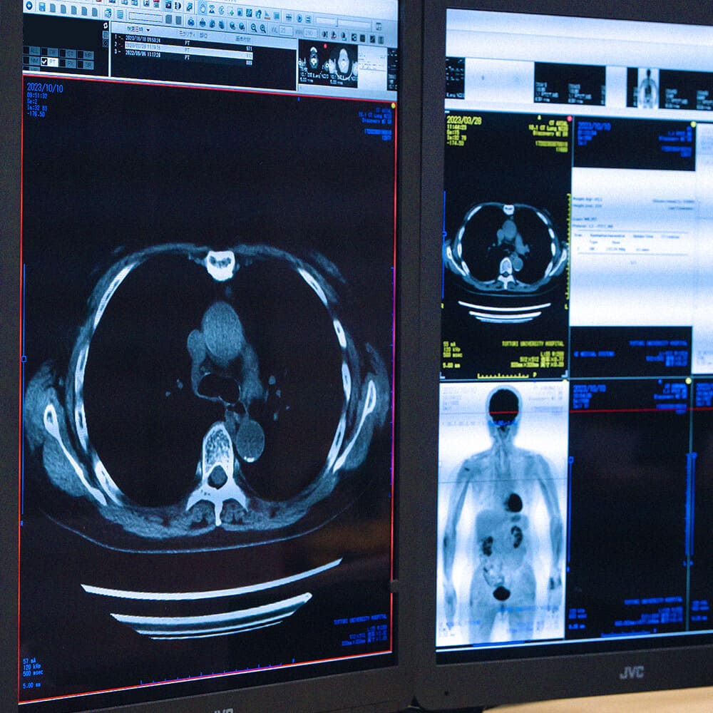 鳥取大学医学部 統合内科医学講座画像診断治療学分野画像診断部門鳥取大学医学部附属病院放射線科医局 放射線治療 画像診断