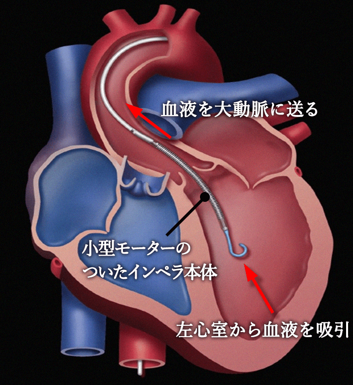 「インペラ」の画像検索結果