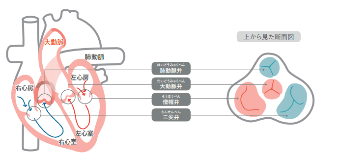 弁膜症