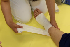 DVT
