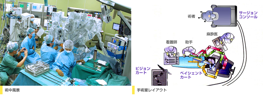 術中風景 手術室レイアウト