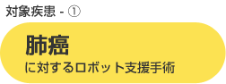 肺癌に対するロボット支援手術