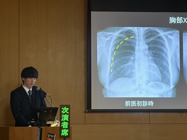 0521関西胸部安田先生