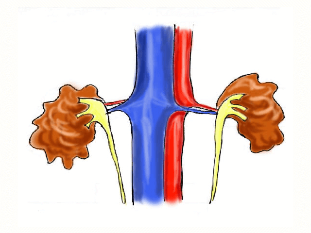 thumbnail_良性疾患-)-慢性腎臓病